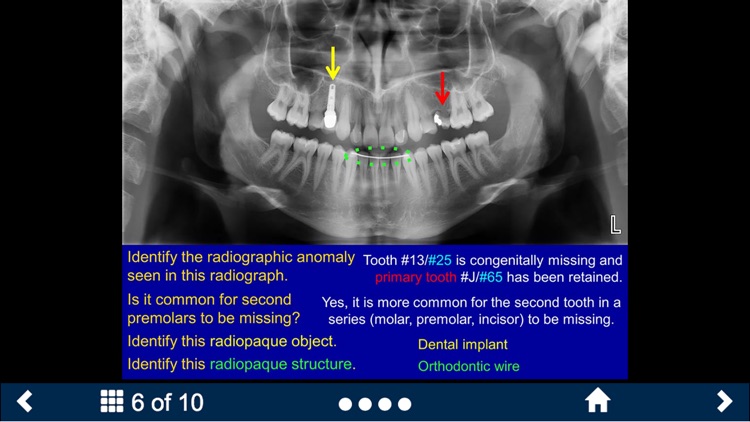 Oral Radiology Lite - SecondLook