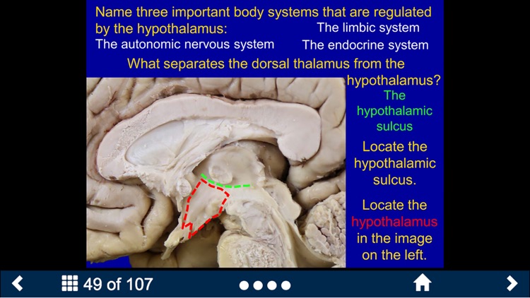 Neuroanatomy - SecondLook screenshot-4