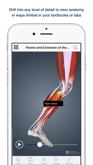 How to cancel & delete 3D Muscle Anatomy from iphone & ipad 3