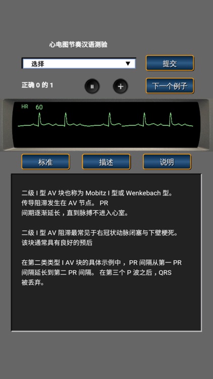 心电图节奏汉语测验 screenshot-3