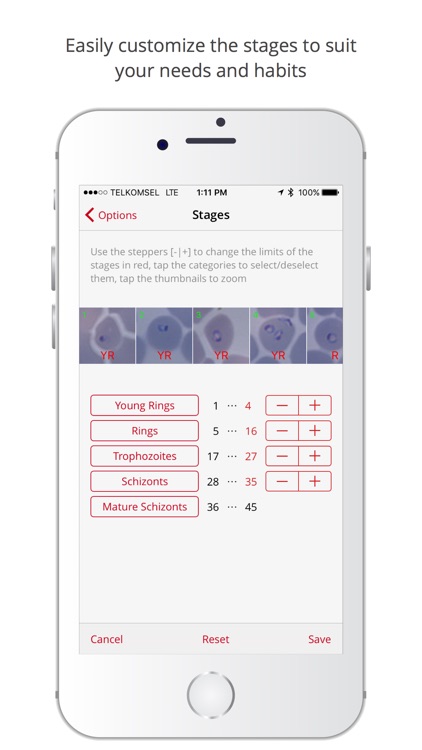 xRapid-Lab: the malaria parasite counter