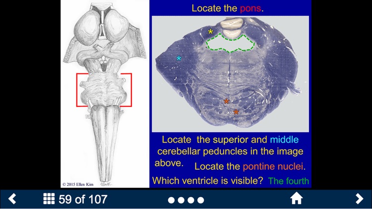 Neuroanatomy - SecondLook