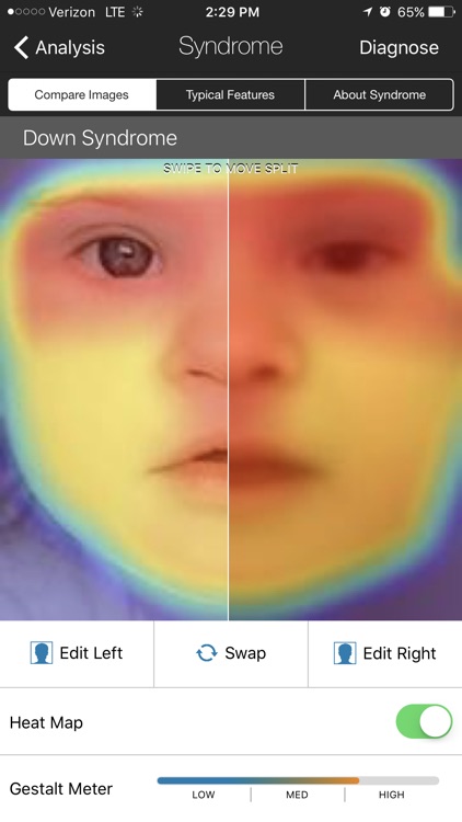 Face2Gene – Smart Phenotyping. Better Genetics.