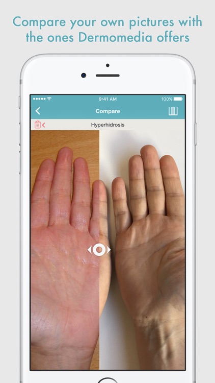 DermoMedia - Education in dermatology screenshot-3