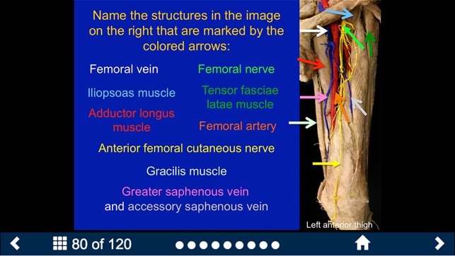 MSK Anatomy - SecondLook(圖3)-速報App