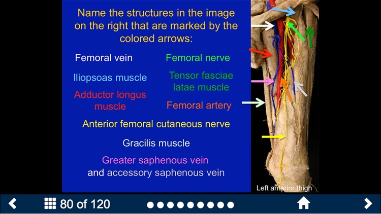 MSK Anatomy - SecondLook