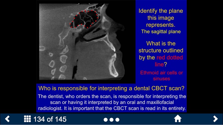 Oral Radiology - SecondLook screenshot-4