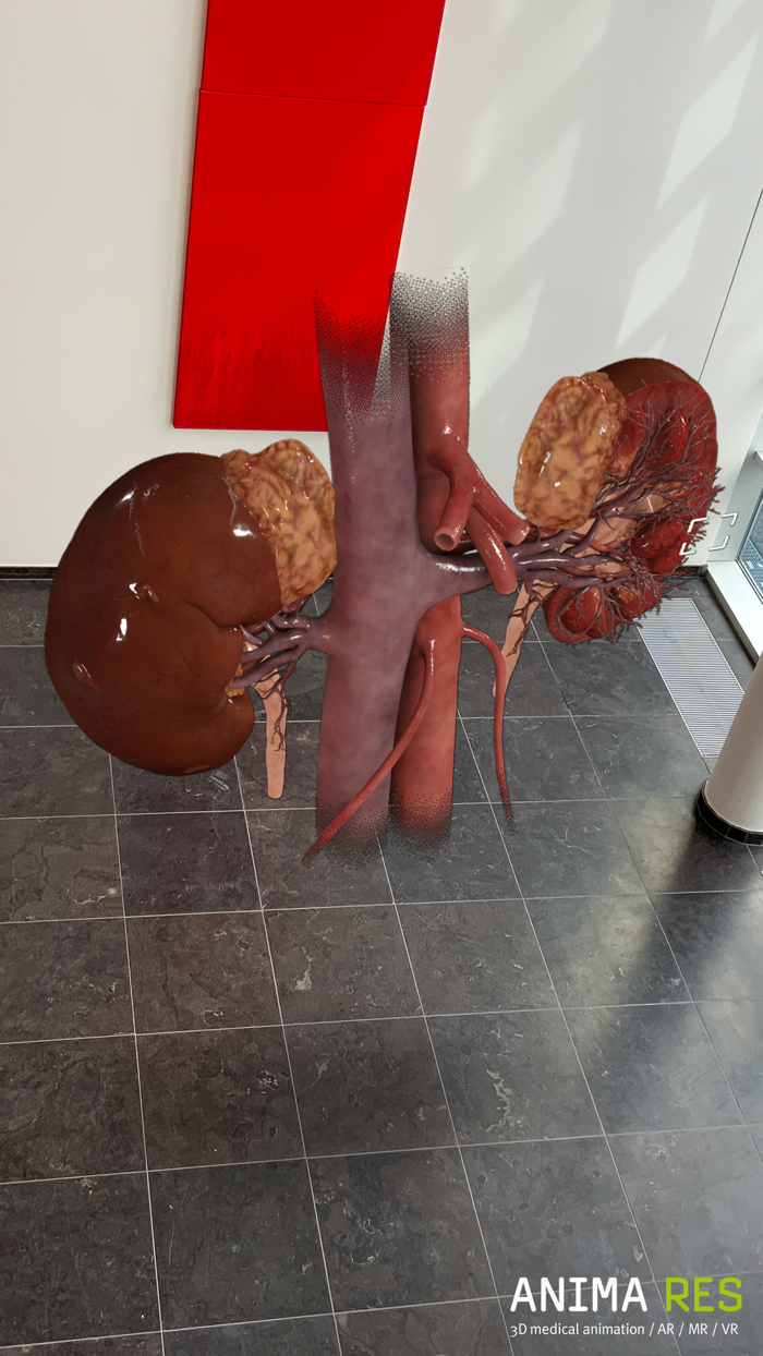 INSIGHT KIDNEY Enterprise