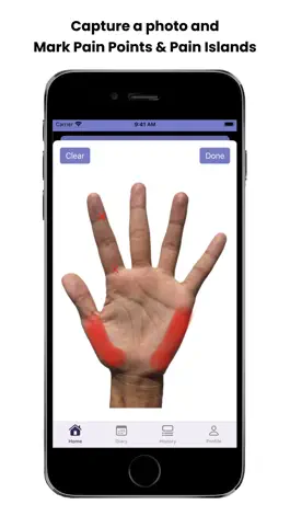 Game screenshot Pain Diary: For Hand Pain apk