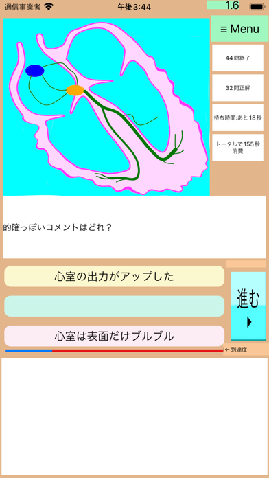 なんちゃって心電図全集(総集編):「1〜最終」を手っ取り早くのおすすめ画像4