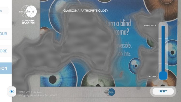 Glaucoma Education screenshot-4