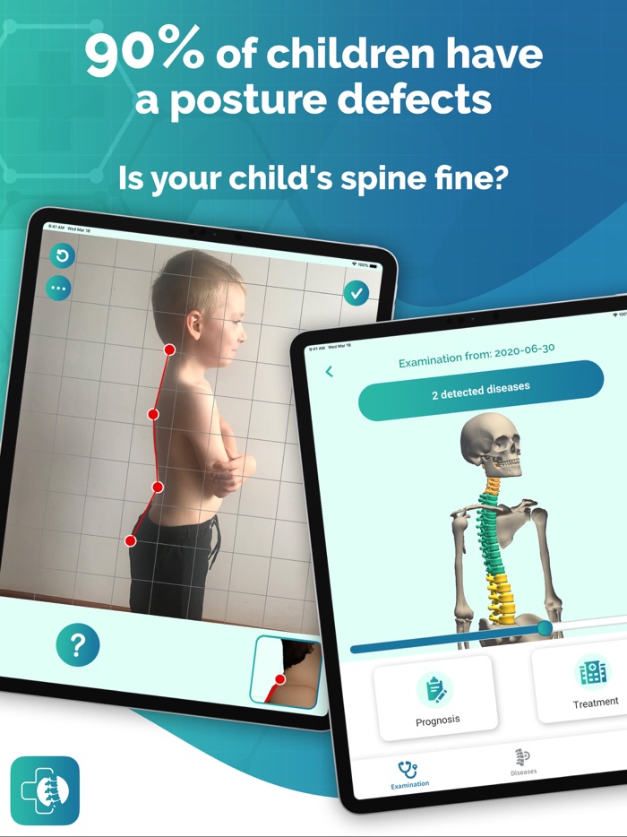 Healthy Back Posture Analysis
