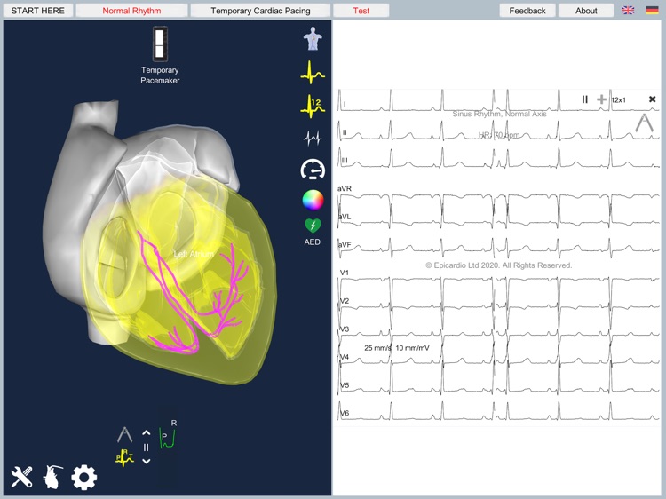 Temporary Cardiac Pacing screenshot-6
