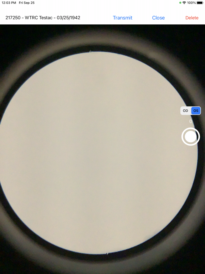 Brane SlitLamp Capture