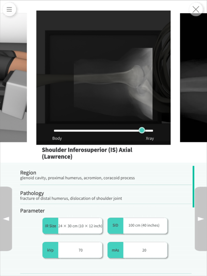 Navi Radiography Pro