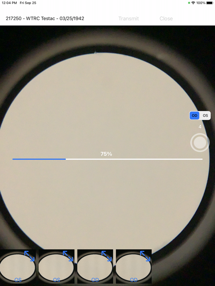 Brane SlitLamp Capture