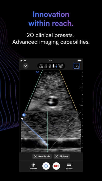 Butterfly iQ — Ultrasound screenshot 2