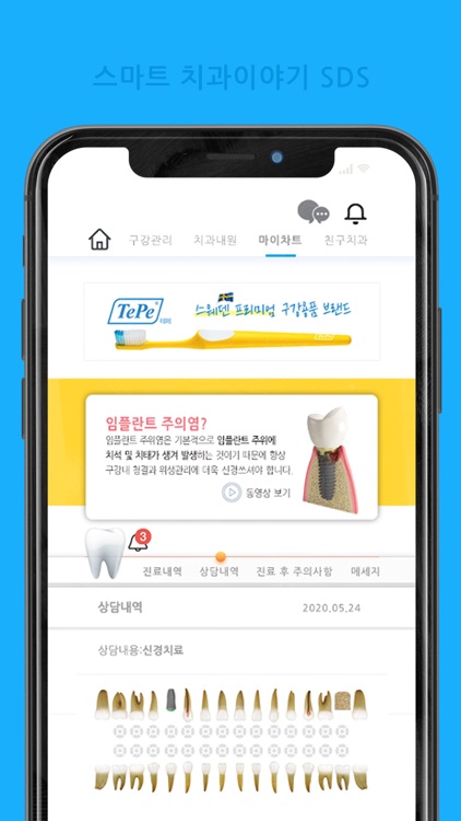 스마트치과이야기 SDS