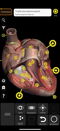 Screenshot 3 Anatomía - Atlas 3D iphone