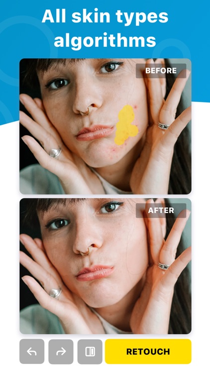 Blemish Editor - Face Tuner