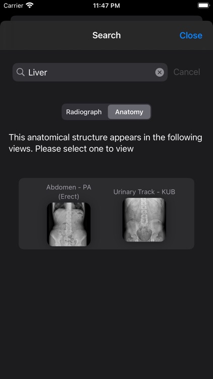 Xray Anatomy screenshot-4