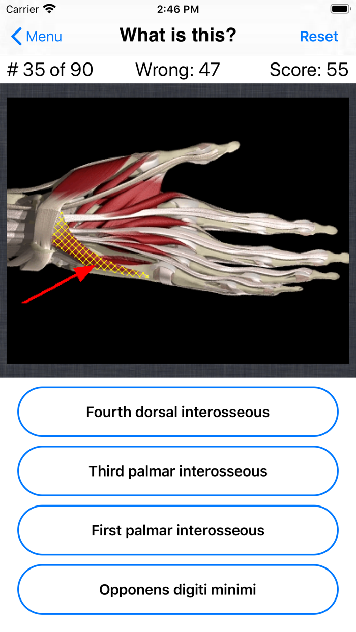 Anatomy Hand Quiz