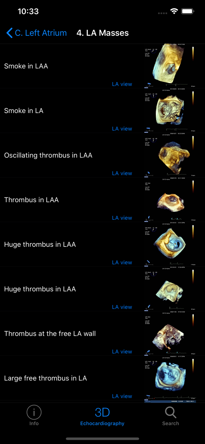 CARDIO3® 3D Echocardiography