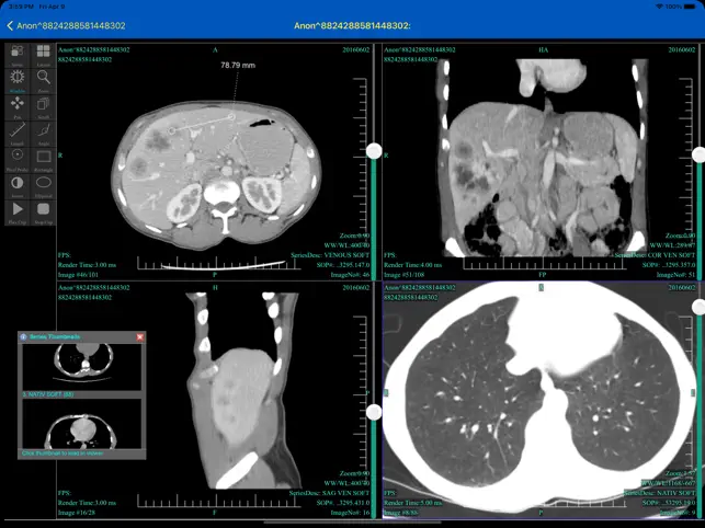 Screenshot 7 dicom.link CloudPACS Client iphone