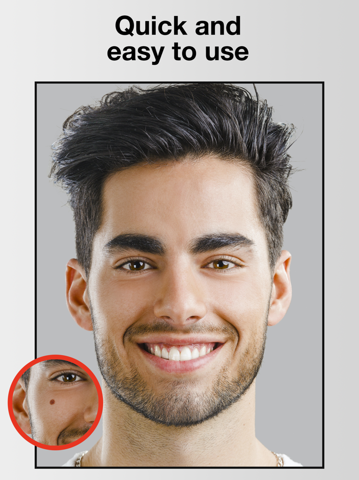 Pimple  Wrinkle Eraser