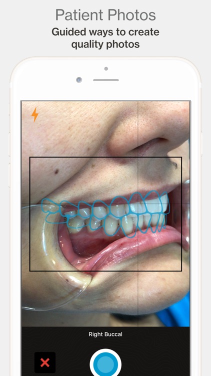 Invisalign Photo Uploader