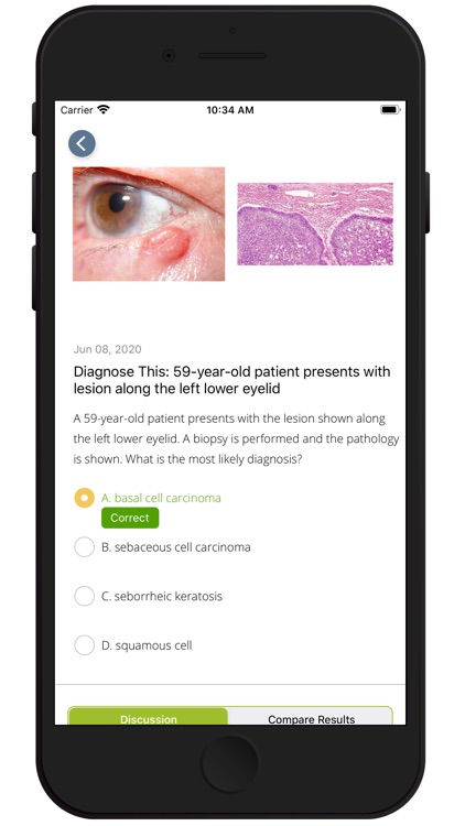 AAO Ophthalmic Education screenshot-3