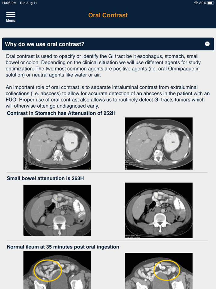 CTisus Contrast Protocols