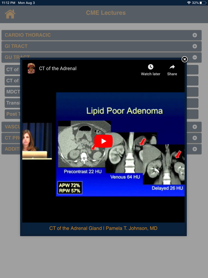 CTisus CT Basics and Beyond