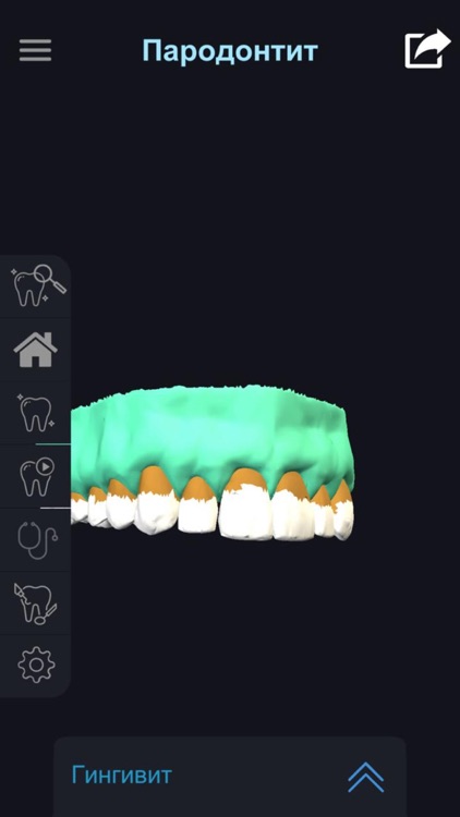 IDental Russian screenshot-3