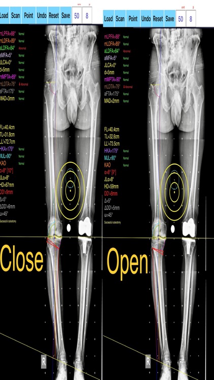 OsteotomyApp screenshot-5