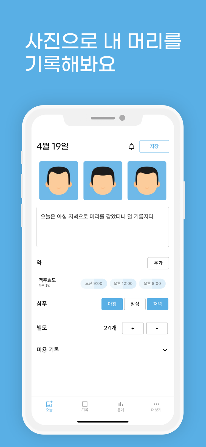 위풍당당 - 머리 사진 기록 탈모 기록