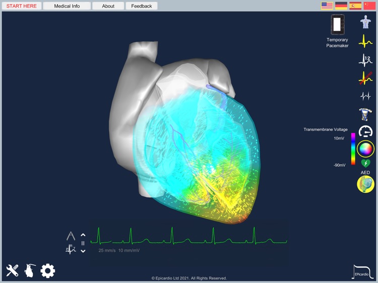 Epicardio Heart Simulator screenshot-8