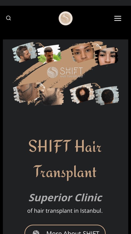 SHIFT Hair Transplant