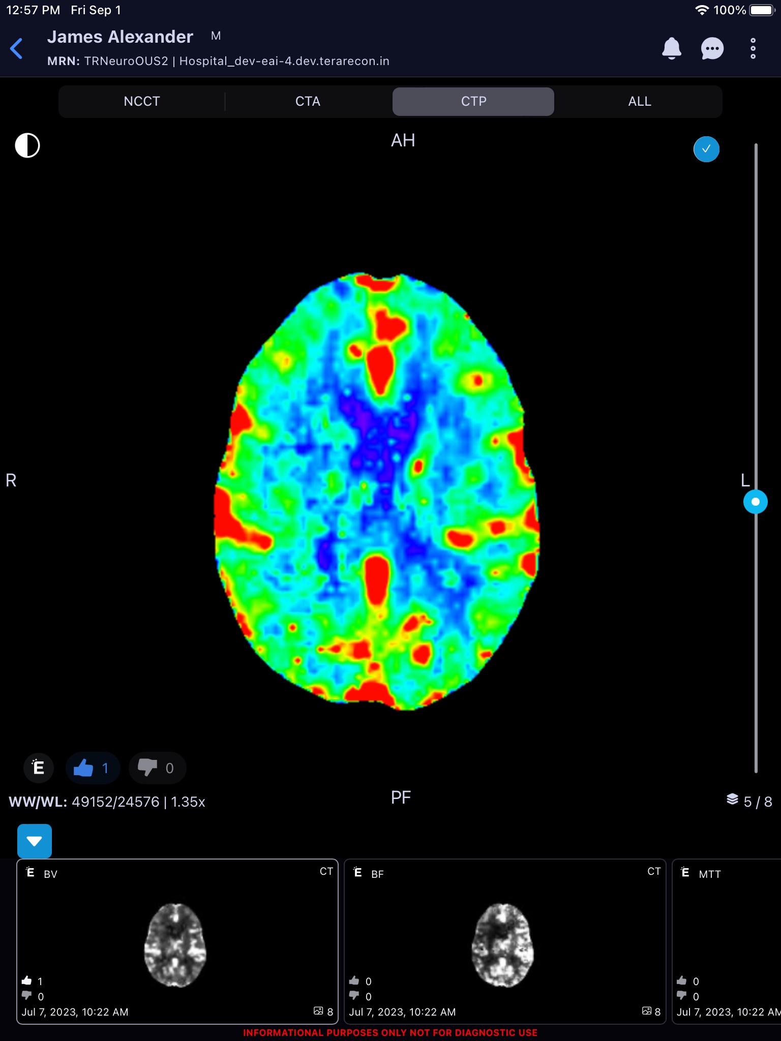 Eureka Clinical AI screenshot 4