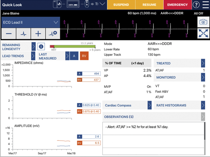 CareLink SmartSync™ RWL