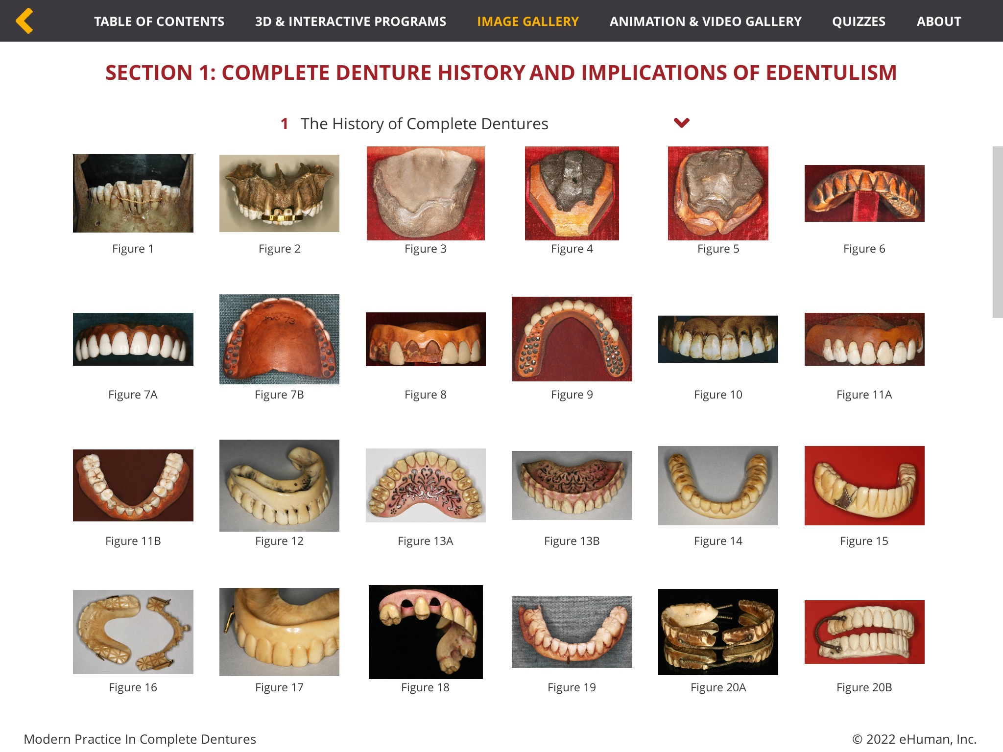 Complete Dentures screenshot 2