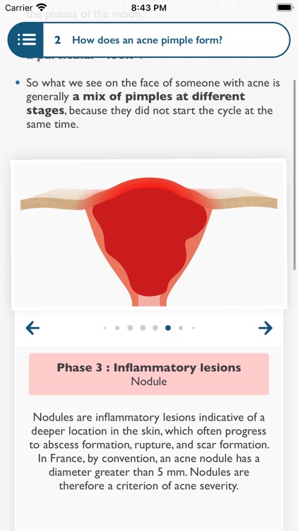 20 Questions on Acne in 2020 screenshot-3