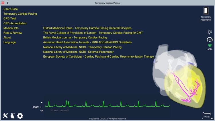 Temporary Cardiac Pacing screenshot-8