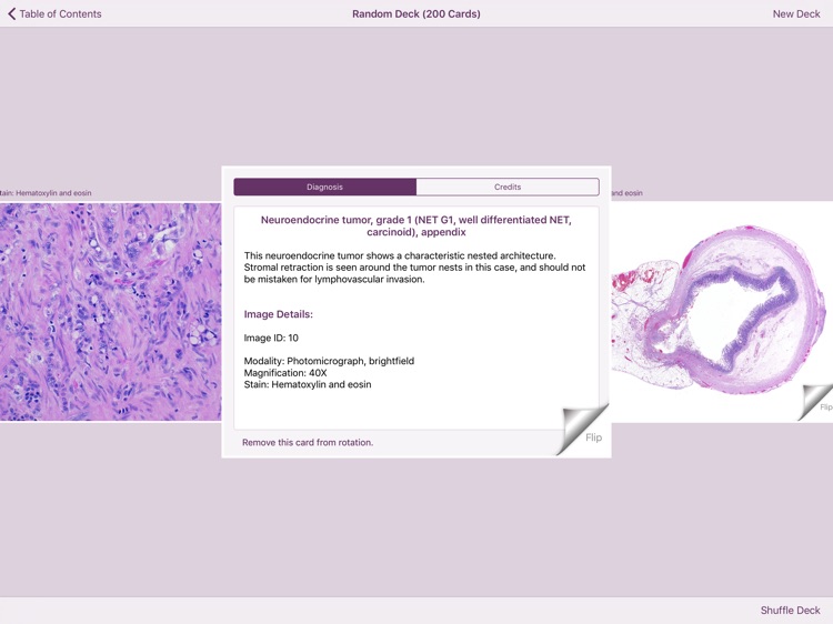 Appendiceal Pathology screenshot-5