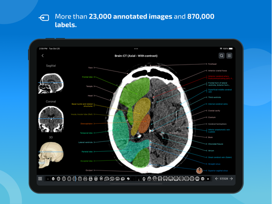 IMAIOS e-Anatomy screenshot 2