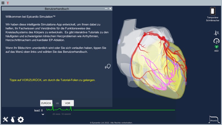 Temporary Cardiac Pacing screenshot-7