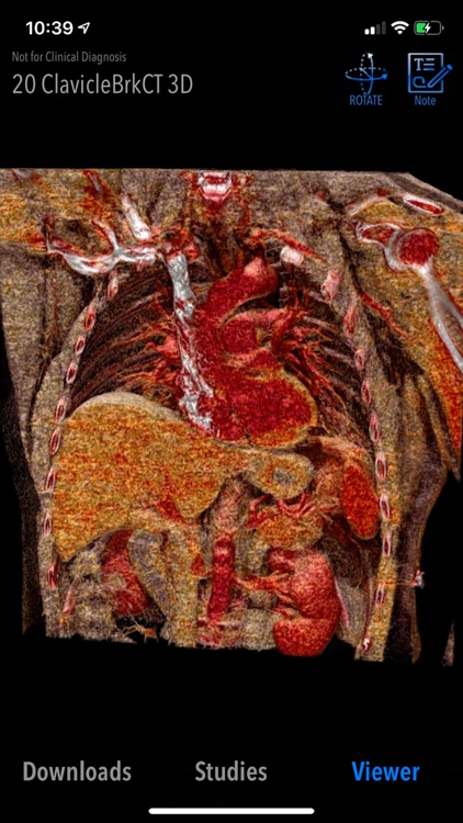 MedVizi™ CT-MRI Viewer screenshot-4