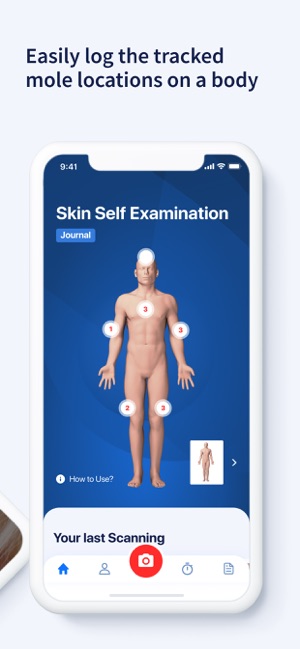 AI Dermatologist: Skin Scanner(圖3)-速報App