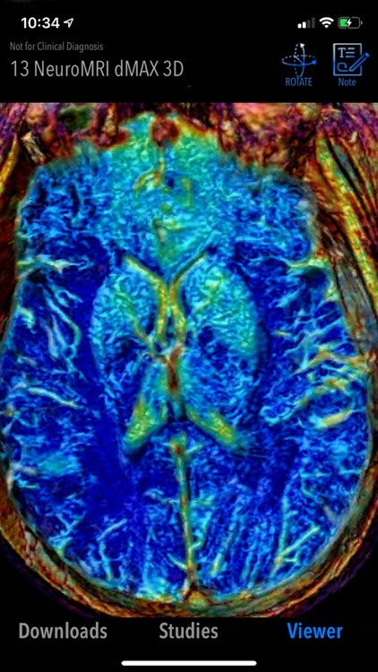 MedVizi™ CT-MRI Viewer