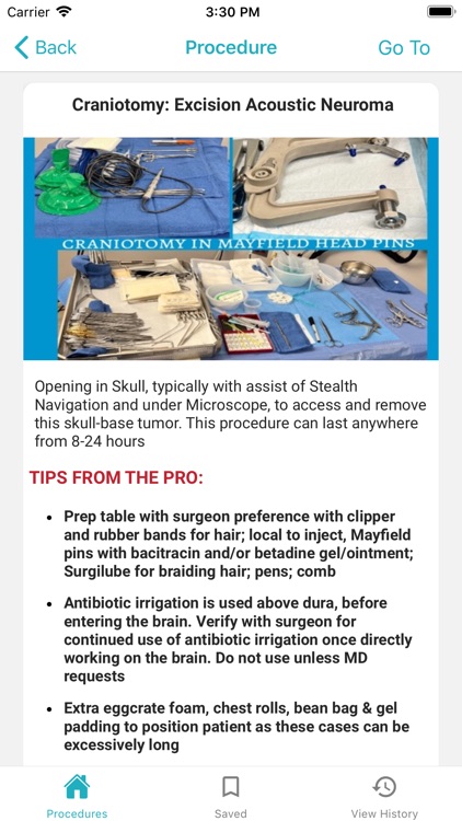 PeriOptimization Lite